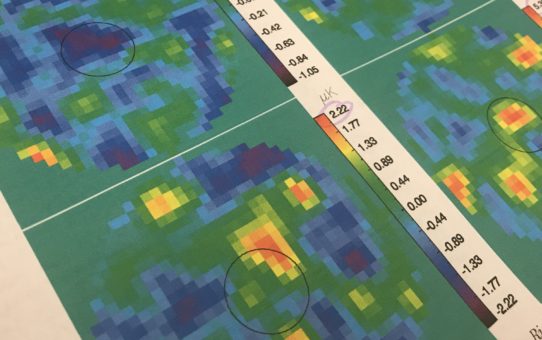 The Sunyaev-Zeldovich Effect